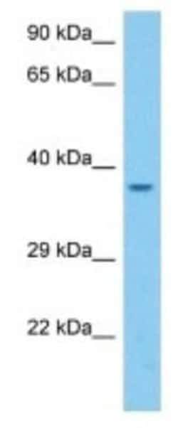 Olfactory Receptor 5 Rabbit anti-Mouse, Polyclonal, Novus Biologicals 100 &mu;g | Buy Online | Novus Biologicals | Fisher Scientific